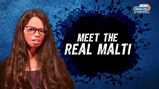 Meet The Real MALTI  Laxmi Agarwal  The Full Story Of That Horrific Day  Chhapaak [upl. by Aubyn]