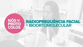 RADIOFREQUÊNCIA FACIAL  BIOORTOMOLECULAR  NÓS AMAMOS PROTOCOLOS [upl. by Kinsley]