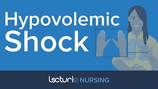 Hypovolemic Shock  Medical Surgical Nursing [upl. by Eitsyrc435]