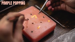 ASMR  PIMPLE POPPING Very satisfying amp relaxing sounds [upl. by Airetal]