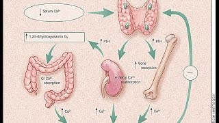 Hyperparathyroidism [upl. by Almeeta]