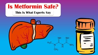 Is Metformin Safe For You This Is What Experts Say Risks vs Benefits Of Taking Metformin [upl. by Naig]