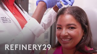 I Tried PRP For Hair Restoration  Macro Beauty  Refinery29 [upl. by Telfer]