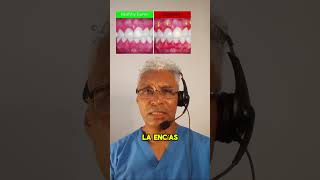 🦷 Que es la gingivitis o 💉 sangramiento de encías [upl. by Trelu980]