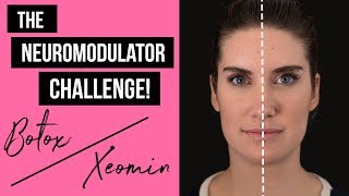 Botox vs Xeomin  The Neuromodulator Challenge [upl. by Amalbergas]