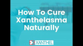 How To Cure Xanthelasma Naturally  Brought To You By XANTHEL ® Easy Xanthelasma Removal [upl. by Kinna]