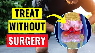 The Best Knee Arthritis Treatments Without Surgery [upl. by Irot]