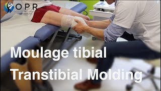 Moulage tibial pour la fabrication d’une prothèse à OPR BretagneNormandie [upl. by Ravahs]