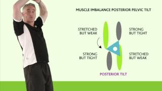 Bones of the Pelvis  Hip Bones  Anatomy Tutorial [upl. by Jaquiss]