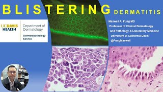 DERMATOPATHOLOGY Blistering Diseases [upl. by Mcspadden716]