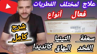 كيتوديرم علاج مضمون للفطريات الجلدية في المناطق الحساسة وللبهاق والقضاء على جميع أنواع التينيا وسعفة [upl. by Moth]