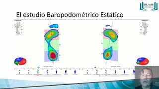 Baropodometría V CONGRESO PODOLOGIA PERU PODOREH [upl. by Bertasi]