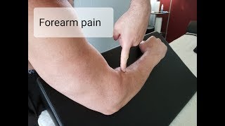 Radial Tunnel Syndrome Forearm pain from screwdriver motion [upl. by Enytsirk]