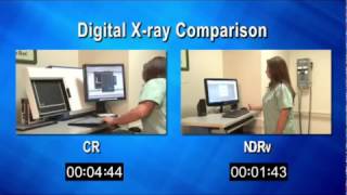 CR amp DR Comparison [upl. by Ttessil]