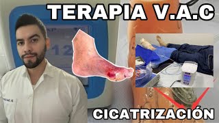 Como Funciona La Terapia VAC  Terapia de cierre asistido por vacío  DR DAVID CAMPOS [upl. by Enorel]