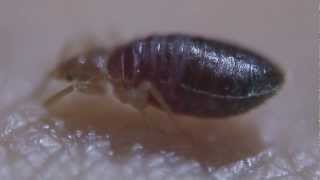 ANTICIMEX ® Ingesta de sangre  Chinches de Cama  Bed bugs [upl. by Rotow832]