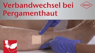 Schmerzfreier Verbandwechsel bei Pergamenthaut  Wundauflagen mit SilikonHaftrand [upl. by Monjan]