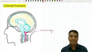 Cisternal Puncture  Suboccipital Puncture [upl. by Dnomed]