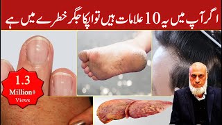 10 Signs Your Liver is in Danger  Lecture 91 [upl. by Whang]