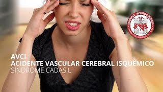 AVCI  ACIDENTE VASCULAR CEREBRAL ISQUÊMICO  Síndrome CADASIL [upl. by Michiko]