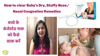 How to Treat Nasal congestionStuffy nose in Babies  Nasobuddy Nasal Aspirator Blocked nose [upl. by Rochkind705]