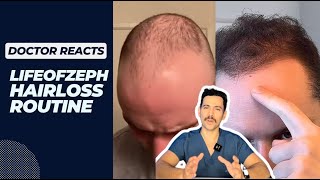 Doctor Reacts to LifeofZephs Hairless Routine for Natural Hair Regrowth 😳 [upl. by Ekoorb919]