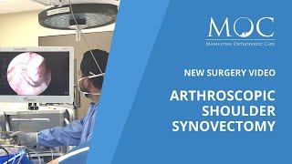 New surgery video Arthroscopic Shoulder Synovectomy [upl. by Leind]