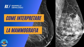 Mammografia con Tomosintesi  Radiologica Romana [upl. by Walling950]