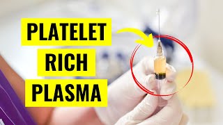 Platelet Rich Plasma PRP Injections Everything You Need to Know [upl. by Jarrell570]