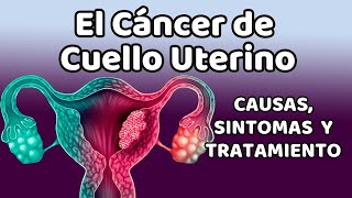 CÁNCER DE CUELLO UTERINO Causas signos y síntomas diagnóstico y tratamiento [upl. by Weatherley]