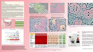 Periodontitis history of a dysbiosis and Cure Slides [upl. by Zenas]