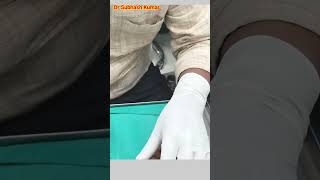 How Lignocaine Is Given Xylocaine कैसे दिया जाता है drsubhashkumar anaesthesia [upl. by Petronella]