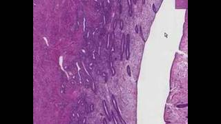 Shotgun Histology Proliferative Endometrium [upl. by Tremann835]