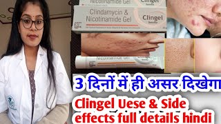 Clingel gel  Clindamycin amp Nicotinamide gel  Clingel review Clingel uese amp Side effects in hindi [upl. by Ahseneuq]