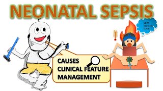 Neonatal sepsis risk factors septic screening  management etc NEONATOLOGY SERIES CH4 [upl. by Morette]