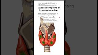 Signs and symptoms of hypoparathyroidism [upl. by Ttezzil]