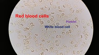 Red Blood Cells under the Microscope 400X and 1000X  Part 1 [upl. by Ahearn]