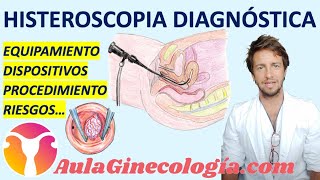 HISTEROSCOPIA DIAGNÓSTICA EQUIPAMINETO PROCEDIMIENTO RIESGOS  Ginecología y Obstetricia [upl. by Ardnekat863]