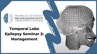 Temporal Lobe Epilepsy Seminar 2 Management [upl. by Ahsinat772]