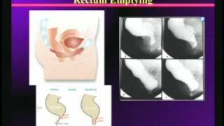 How the Gastrointestinal System Works and Goes Awry [upl. by Stoeber]