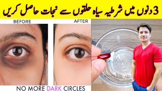 How To Remove Dark Circles Naturally in 3 Days By ijaz Ansari  Dark Circles Homemade Removal Cream [upl. by Mara369]