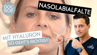 NASOLABIALFALTEN MIT HYALURON ERKLÄRT von Dr Rolf Bartsch [upl. by Rowen]