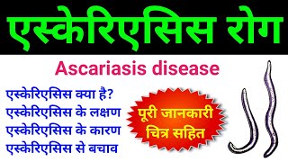 एस्केरिएसिस क्या है  ascariasis class 12  ascariasis microbiology  ascariasis disease in hindi [upl. by Ahsinam268]