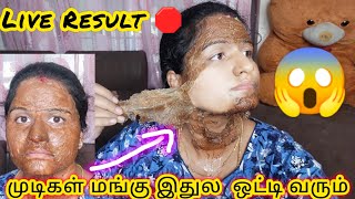 இது தெரிஞ்சா இனி Parlour பக்கமே போக மாட்டிங்க Facial Hair Remove Home Remedyjasvikamedia [upl. by Solraced]