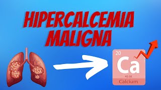 Hipercalcemia Maligna Explicado Claramente [upl. by Searby229]