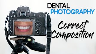 Dental Photography Basics  How to Take a Quality Dental Photo  Correct Composition [upl. by Ssilb]