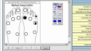 How to Perform a Monofilament Test for Neuropathy [upl. by Devon871]