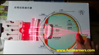 Long Sightedness and Short sightedness [upl. by Neu]